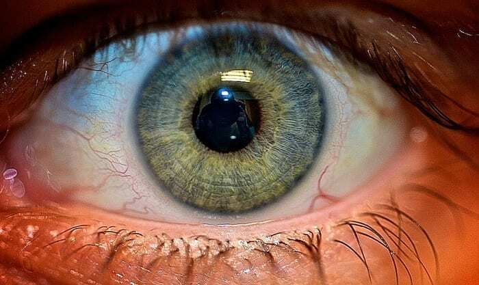 сканирование радужной оболочки глаза