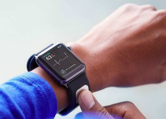 EKG hodiniek Apple Watch