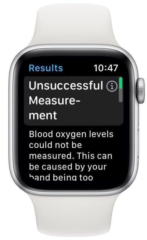 قياس جهاز قياس الأكسجين في الدم غير ناجح ، أعد المحاولة