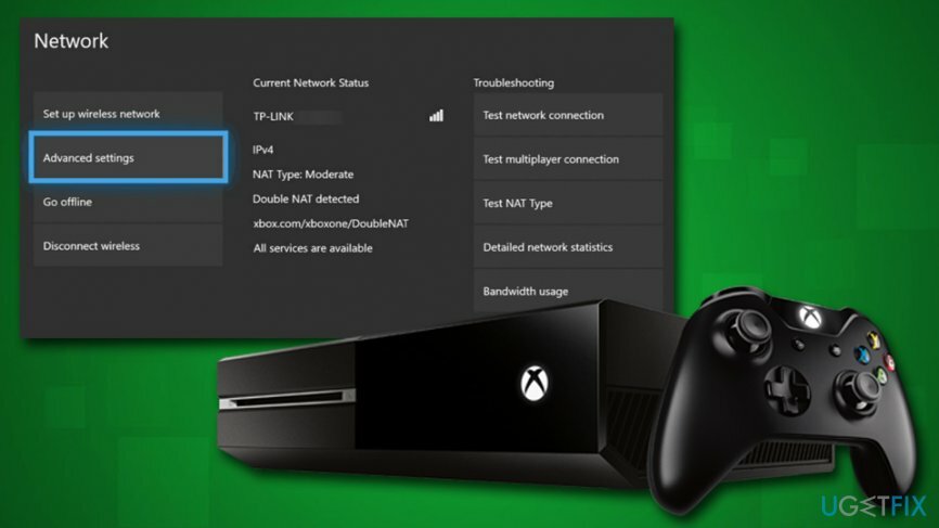 Xbox'ta Netflix hatası NW-2-5'i düzeltin